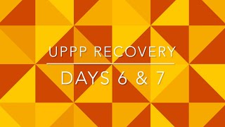 UPPP Patient Recovery Vlog Days 6 amp 7 [upl. by Jenny]