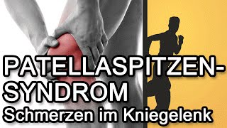 Patellaspitzensyndrom  Jumpers Knee  Ursachen amp Symptome Teil 1 [upl. by Artenra]