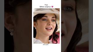 Amy Jackson transformation 💔🥺new look amyjacksonfans shorts viralvideo trending youtubeshorts [upl. by Rizika]