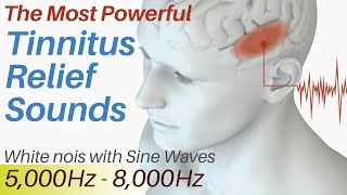 Tinnitus Relief Sounds  White Noise amp Sine Waves 5000Hz  8000Hz  Tinnitus Sound Therapy [upl. by Luca]