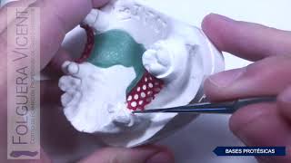 Estructura en cera de una prótesis dental metálica [upl. by Llerehs]