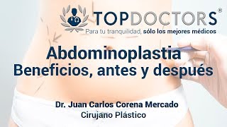 Abdominoplastia o cirugía del abdomen Beneficios antes y después [upl. by Odo266]