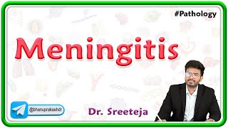 4 Meningitis  USMLE Step 1 Pathology [upl. by Elfont]