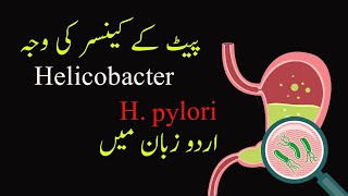 Understanding H Pylori The Stomach CancerCausing Bacteria  Symptoms Treatment amp Prevention [upl. by Capriola]