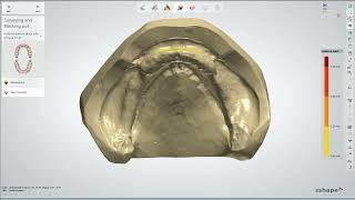 Full Denture Design with 3Shape [upl. by Hanshaw]