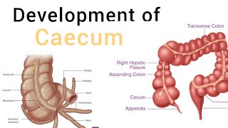 Development of Caecum and appendix  Embryology mbbs lectures [upl. by Gebhardt77]