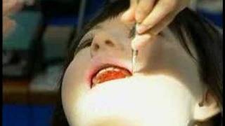 Android Robot used by dentists to detect pain [upl. by Amby]