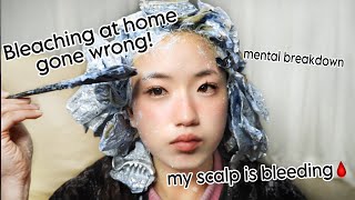 BLEACHING MY HAIR AT HOME WENT HORRIBLY WRONGbleach burnblood scabs and healing [upl. by Belinda]