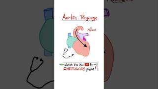 Aortic Regurgitation AR  Valvular Heart Disease VHD…biology science cardiology anatomy [upl. by Atteram]