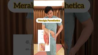 Rehabilitasi “Meralgia Paresthetica” 🫶🏻 pahakesemutan [upl. by Imuy]