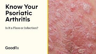 Know Your Psoriatic Arthritis Is It a Flare or Infection  GoodRx [upl. by Enomad]