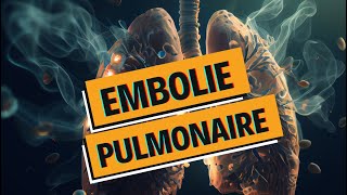 EMBOLIE PULMONAIRE et PHLEBITE  tout comprendre  WhyDoc 1 [upl. by Arelc]