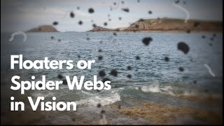 Seeing Floaters or Spider Webs in Vision  EXPLAINED  Dr DOrio Eyecare [upl. by Nosnaj912]