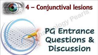 Conjunctival Lesions PG Entrance Questions amp Discussion 4 [upl. by Nosnah]