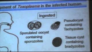 DrAzaa 10  Toxoplasmosis [upl. by Laidlaw510]