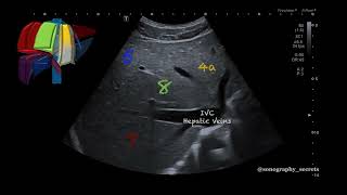 Ultrasound Liver Segments [upl. by Sarson]