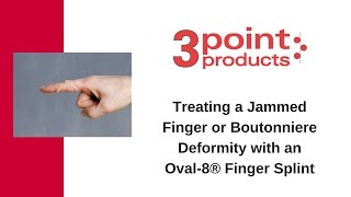 How to Treat Boutonniere Deformity with an Oval8 Finger Splint  3Point Products [upl. by Pooh]