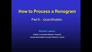 How to Process a Renogram Part6 [upl. by Letti]