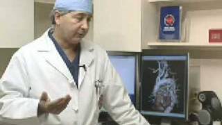 Thoracic Aneurysm Repair [upl. by Itirahc]