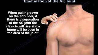 Examination Of The AC Joint  Everything You Need To Know  Dr Nabil Ebraheim [upl. by Rena]