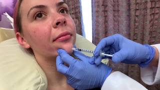 Botox for Chin Dimpling Preventing Wrinkles with Dr Michelle Ellern [upl. by Dolan]