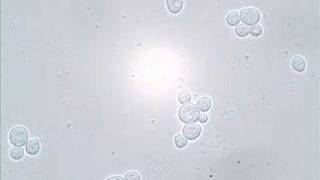 Budding and Shmooing  Yeast Reproduction [upl. by Barbaraanne]