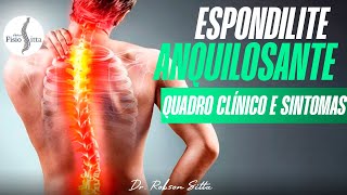 EXAME FÍSICO QUADRO CLÍNICO e SINTOMAS ESPONDILITE ANQUILOSANTE  Fisioterapia Dr Robson Sitta [upl. by Haggar855]