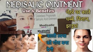 Medisalic Cream Review  Clobetasol Propionate Salicylic Acid Ointment  use and Benefits [upl. by Oiram]