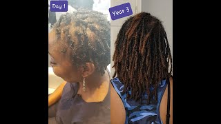 3YEAR LOC JOURNEY  LOCS amp ALOPECIA  LOCS ON THIN AND LOW DENSITY HAIR  PLUS A LITTLE RANT [upl. by Fabien]