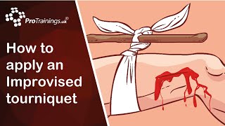 How to apply an Improvised tourniquet for catastrophic bleeding [upl. by Luthanen]