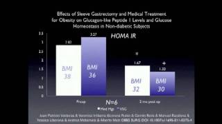 Bariatric Surgery PG Course Sleeve Gastrectomy Neurohormonal Control of Obesity Diabetes [upl. by Norek]