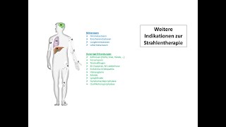 Weitere Indikationen zur Strahlentherapie  Strahlentherapie Prof Hilke Vorwerk [upl. by Analak]