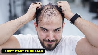 I Dont Want To Be Bald l Thin Hair Transformation by Barber [upl. by Yennep]