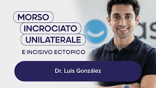 Dr Luis González  Morso incrociato unilaterale e incisivo ectopico [upl. by Tuchman]