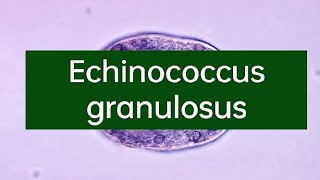 Echinococcus granuloses [upl. by Mose862]