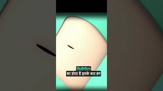 चलिए देखते हैं कैसे होती है हार्ट की एंजियोग्राफीAnimated Heart Angiography Procedure [upl. by Calvina96]