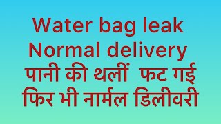 Water bag leak normal delivery in delivery hut 🛖 पानी की थलीं फट गई फिर भी नार्मल डिलीवरी [upl. by Raseta554]