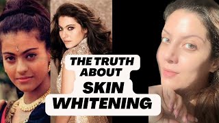 Bollywood Actress Skin Whitening Treatment I Whitening Injection I Whitening Treatment for Skin [upl. by Wilburn157]