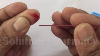 Blood Clotting Time Determination by Using Capillary Method  Blood Clotting Time Test  ENGLISH [upl. by Comfort]