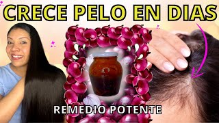 MEZCLA ESTO EN TU SHAMPOO Y TU CABELLO NO PARARÁ DE CRECER 😱SHAMPOO DE CEBOLLA😍REMEDIO POTENTE [upl. by Queridas]