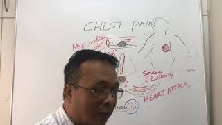 chest painAnginaMI and GERD Nursing video amp year 1 MBBS [upl. by Gardell868]