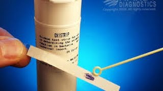 Microbiology oxidase test [upl. by Avir]