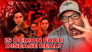 REAL Demon Face Syndrome RevealedShapeshifters Among Us You Will Not Believe This [upl. by Orabelle]