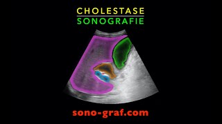 Sonografie  Cholestase [upl. by Hetty894]