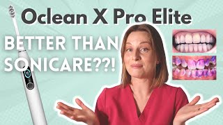 Oclean X Pro Elite Electric Toothbrush Review Vs Sonicare SenseIQ  Discount Codes [upl. by Angell504]