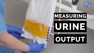 Measuring Urine Output  OSCE Guide  Catheter  UKMLA  CPSA [upl. by Ahtrim]