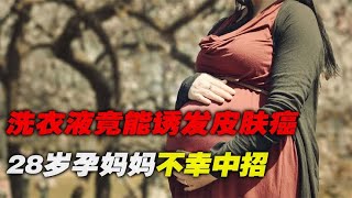 洗衣液竟是荧光毒液！28岁孕妈妈不幸中招，看完你还敢用吗？ [upl. by Akimal]