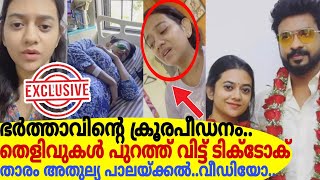 ഭർത്താവിന്റെ ക്രൂരപീഡനംതെളിവുകൾ പുറത്ത് വിട്ട് ടിക് ടോക് താരം അതുല്യ പാലയ്ക്കൽEXCLUSIVE VIDEO [upl. by Ennovad]