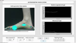 Anthropometric Vision System Proposed System [upl. by Ajam154]