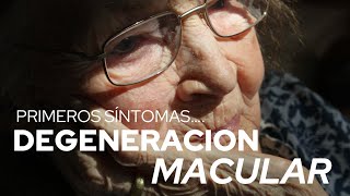 ¿Que es la MACULOPATIA o DEGENERACIÓN MACULAR¿Cuáles son los sintomas Dr Alejandro Lavaque [upl. by Aztinaj973]